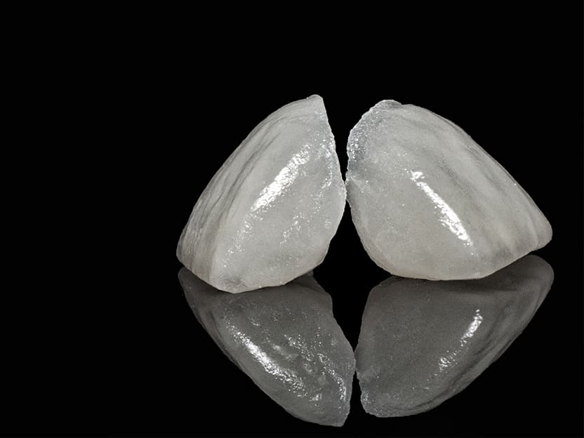 美しい白い歯に