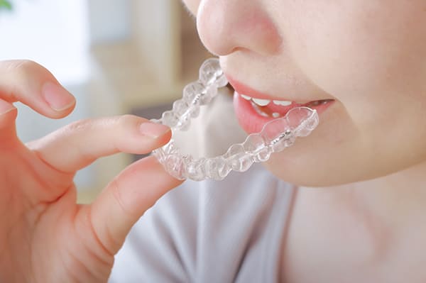 歯ぎしり用のナイトガード