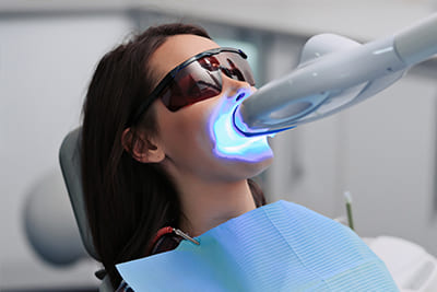 オフィスホワイトニング