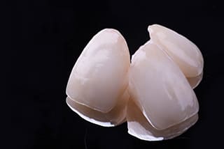 歯の形や色彩を美しく・セラミック審美治療