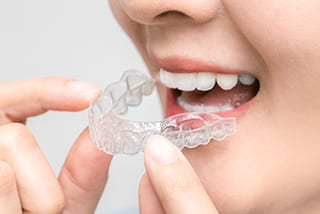 透明で取外せる矯正治療・マウスピース矯正