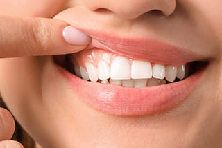 歯ぐきに違和感・口臭が気になる・歯周病治療